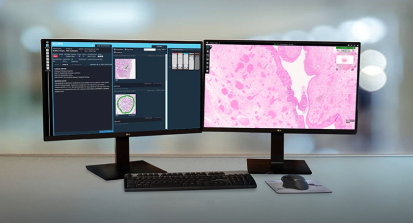 Fujifilm, mTuitive Partner to Integrate Digital Pathology Platforms